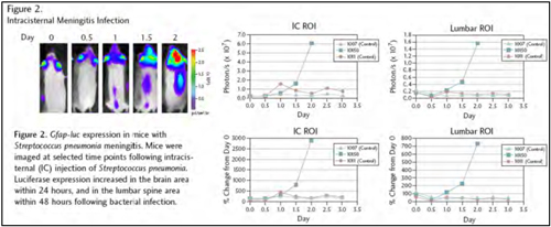 Intracisternal Meningitis Infection