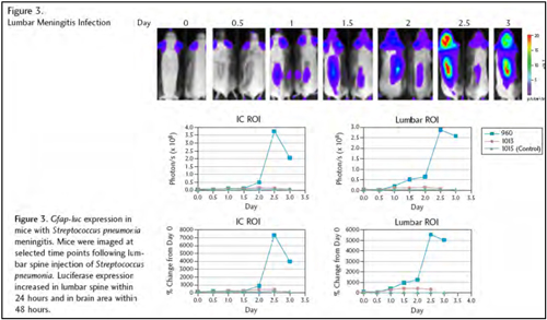 Lumbar Meningitis Infection