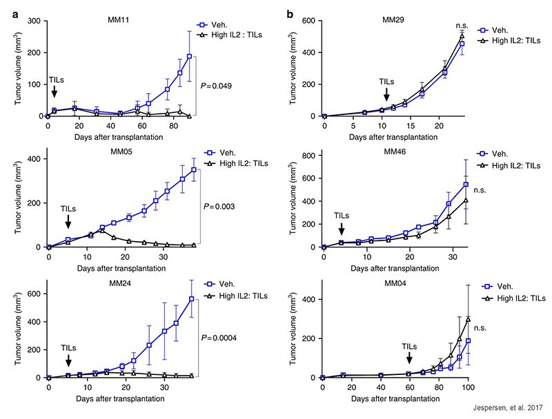 Adoptive cell transfer in hIL-2 NOG mice correlates with response in patients