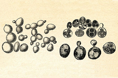 Yeast Worsens Disease in a Mouse Model of Colitis Yeast Worsens Disease in a Mouse Model of Colitis